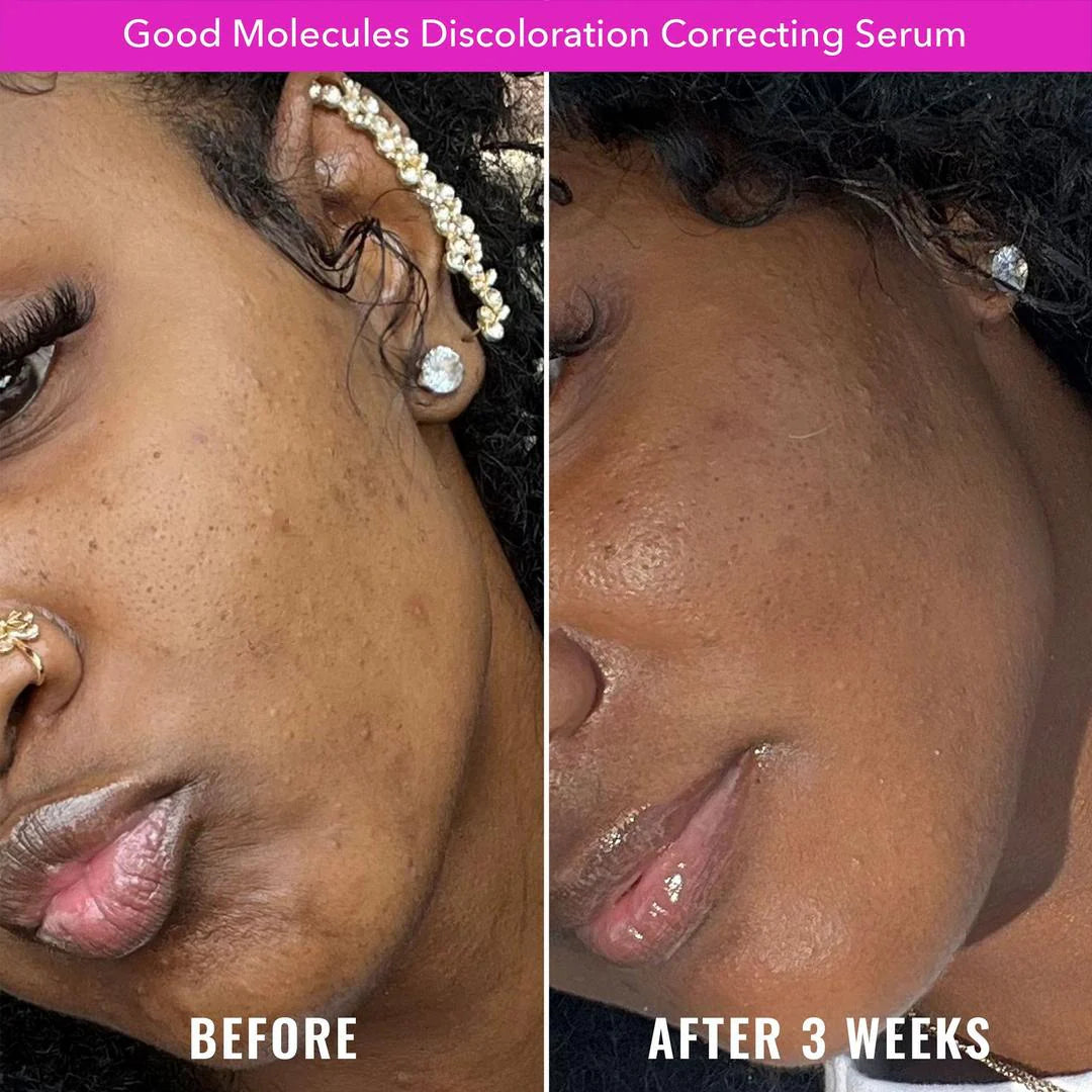 Discoloration Correcting Serum