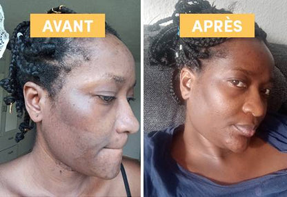 Macérat huileux de Busserole