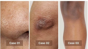 Kojic Acid Tumeric Toning Cleanser