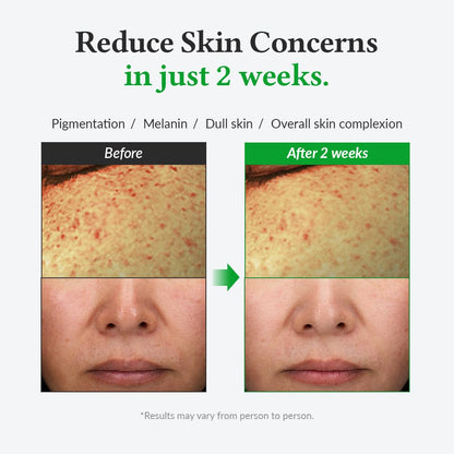 Gentle Vitamin C Serum