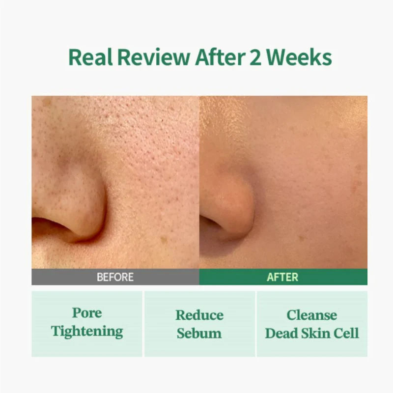Green Tomato Pore Lifting Ampoule+
