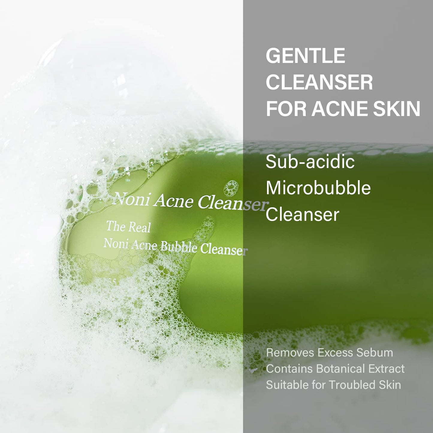 The Real Noni Acne Bubble Cleanser