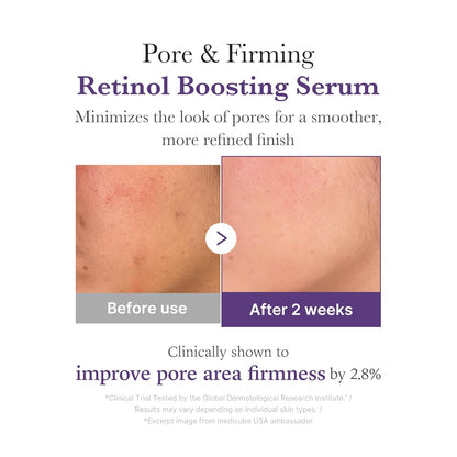 Retinol NMN Boosting Serum
