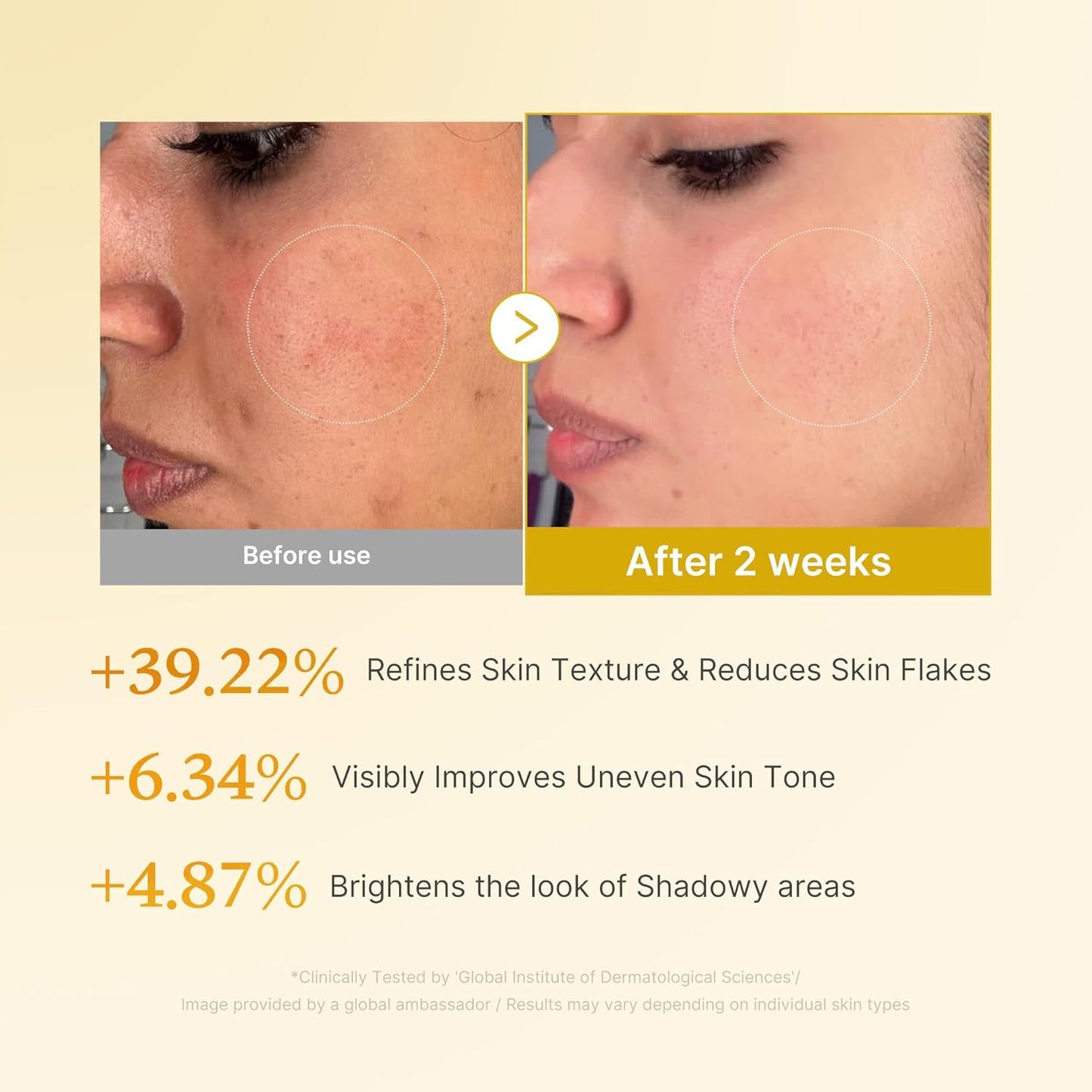 Kojic Acid Turmeric Resurfacing Toner