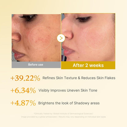 Kojic Acid Turmeric Resurfacing Toner