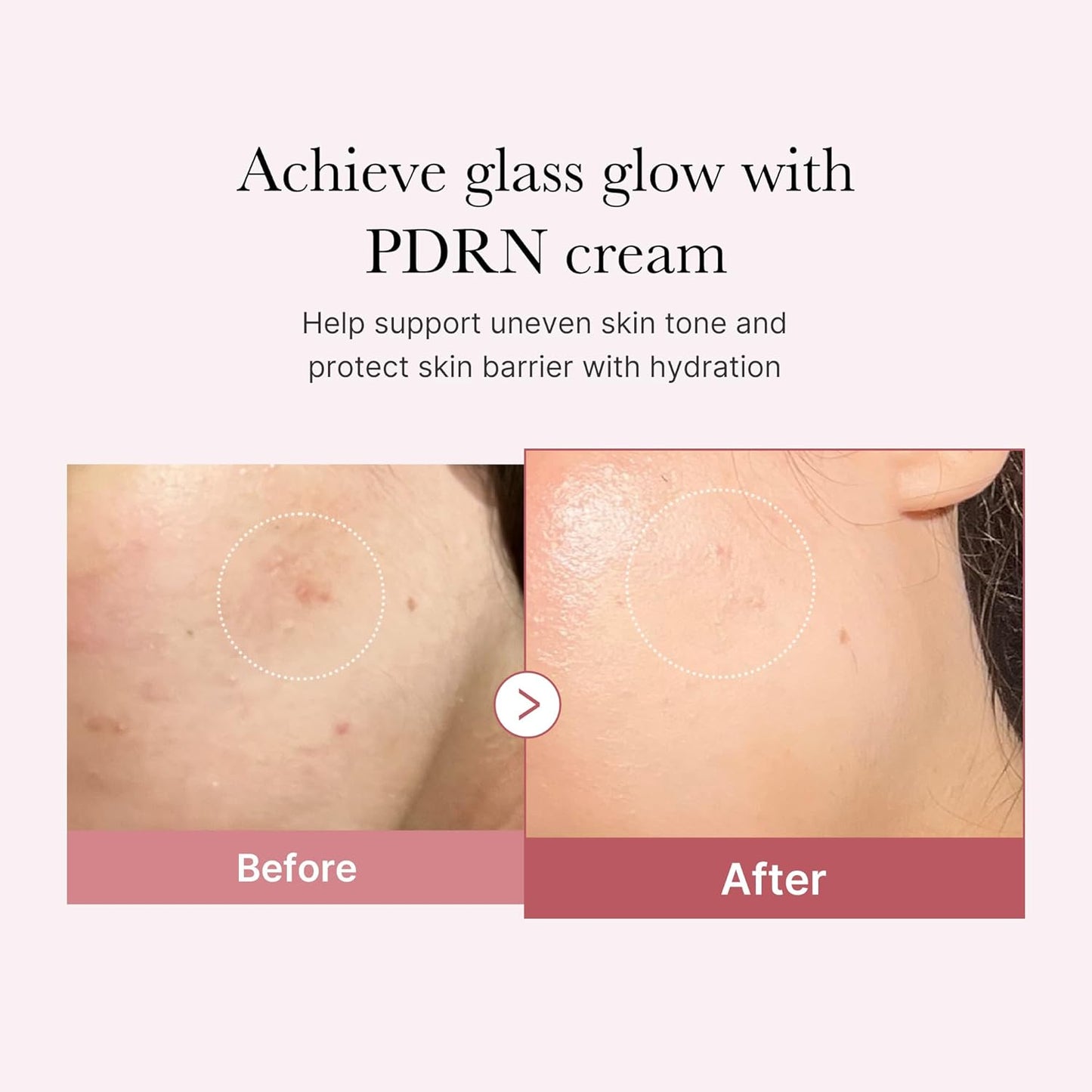 PDRN Pink Hyaluronic Moisturizing Cream
