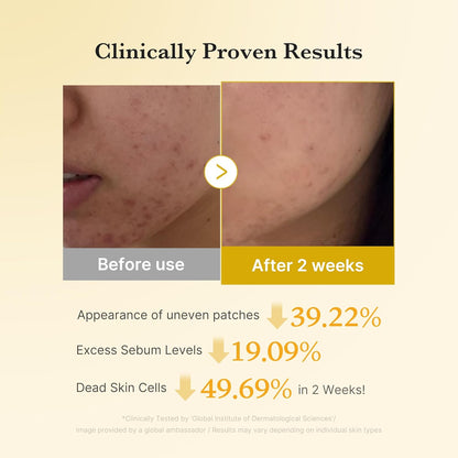 Kojic Acid Turmeric Toner Pad