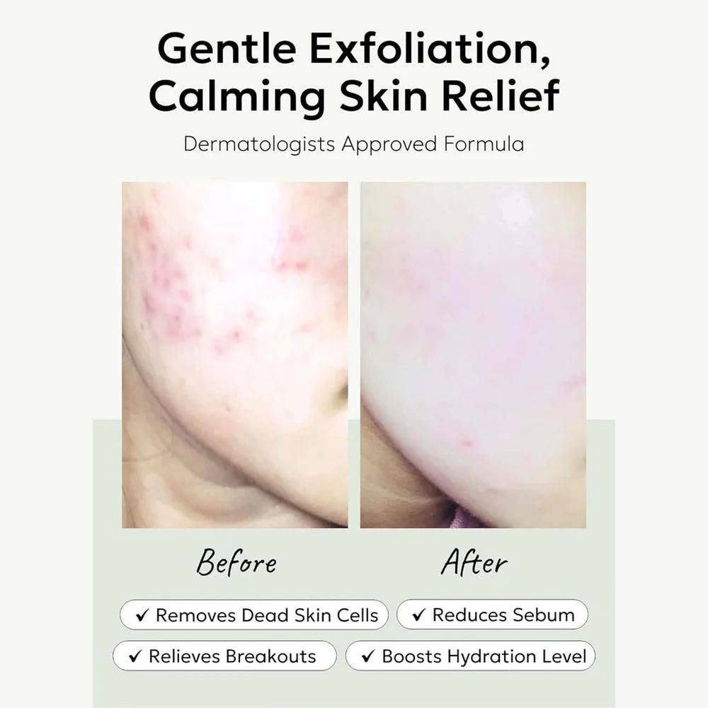 Ji Woo Gae Heartleaf BHA Peeling Pad