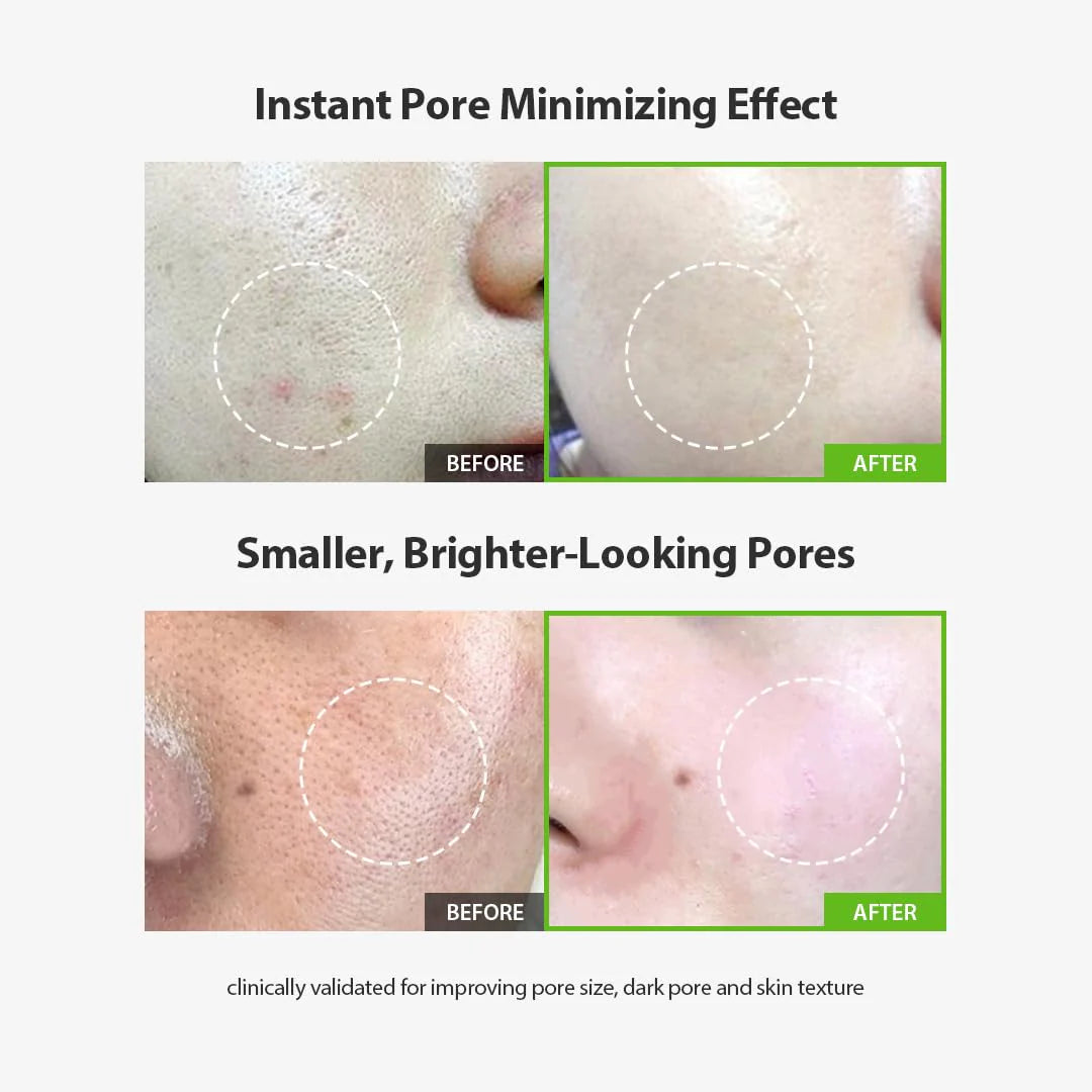 Green Tomato Pore Lifting Ampoule+