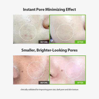 Green Tomato Pore Lifting Ampoule+