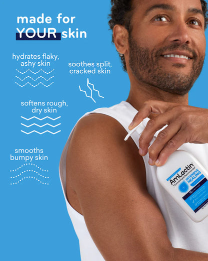 Intensive Healing Lotion with 15% Lactic Acid AHA