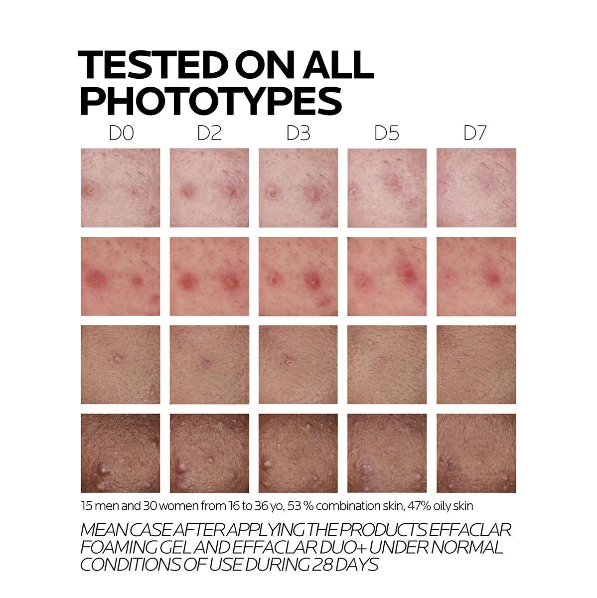 EFFACLAR DUO+M TRIPLE SOIN CORRECTEUR ANTI-IMPERFECTIONS