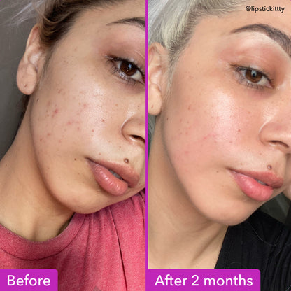 Niacinamide Brightening Toner